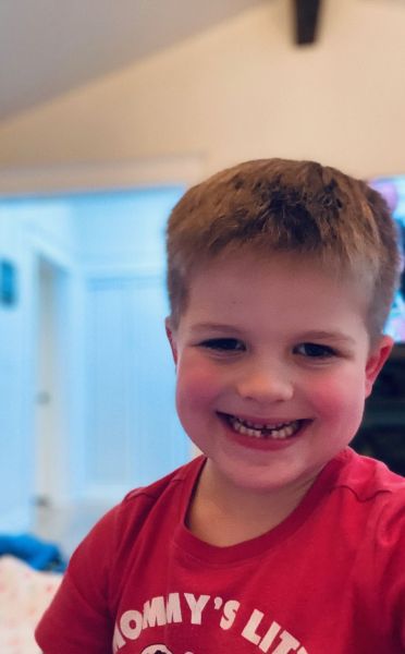 Wilson first tooth 2